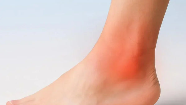 Sprain or Strain? Know the Difference