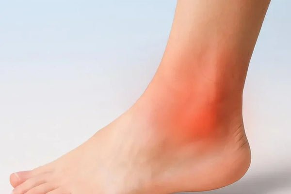 Sprain or Strain? Know the Difference